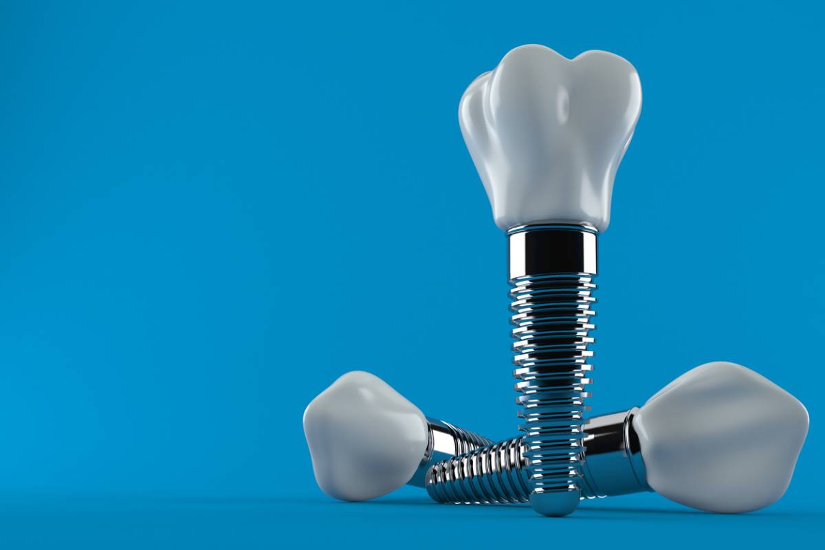 image of dental implants against blue background