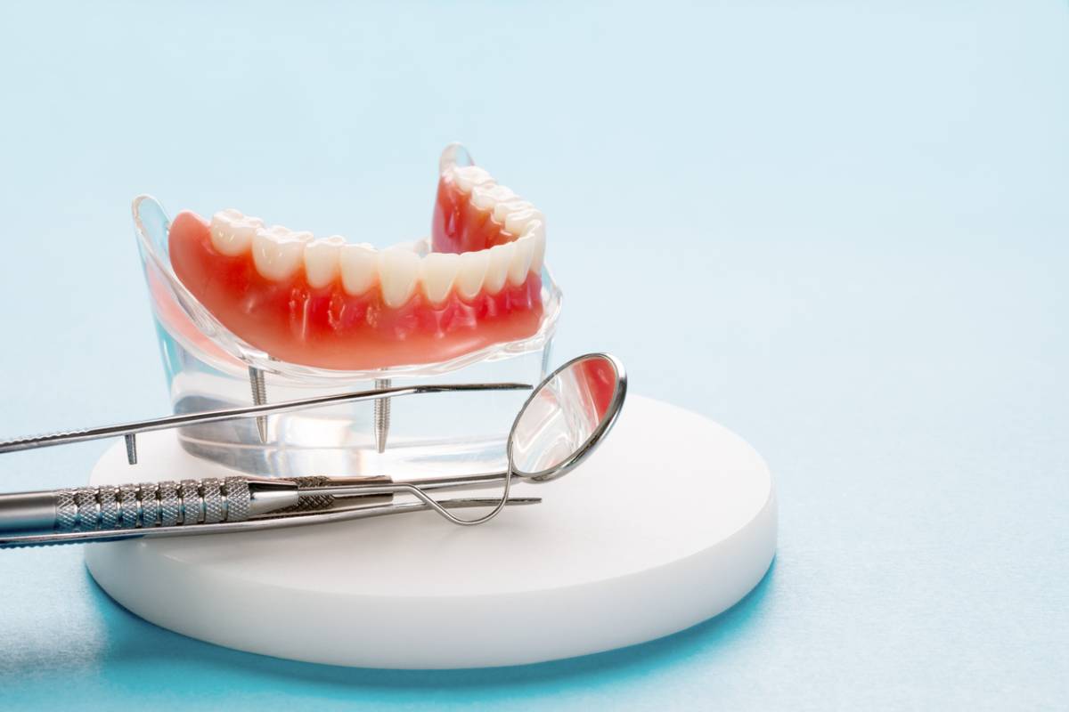 concept image of advantages of implant dentures