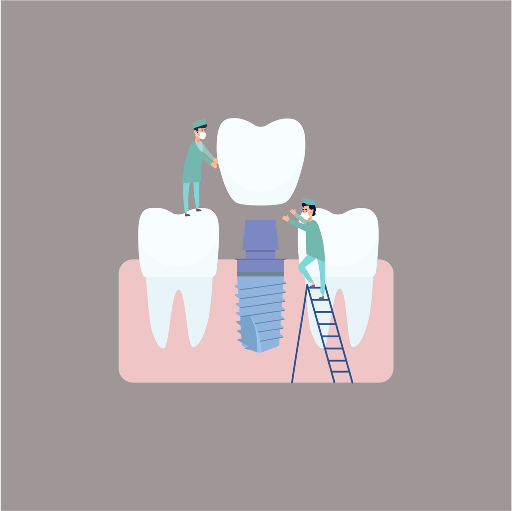 concept of dental implants as a good investment