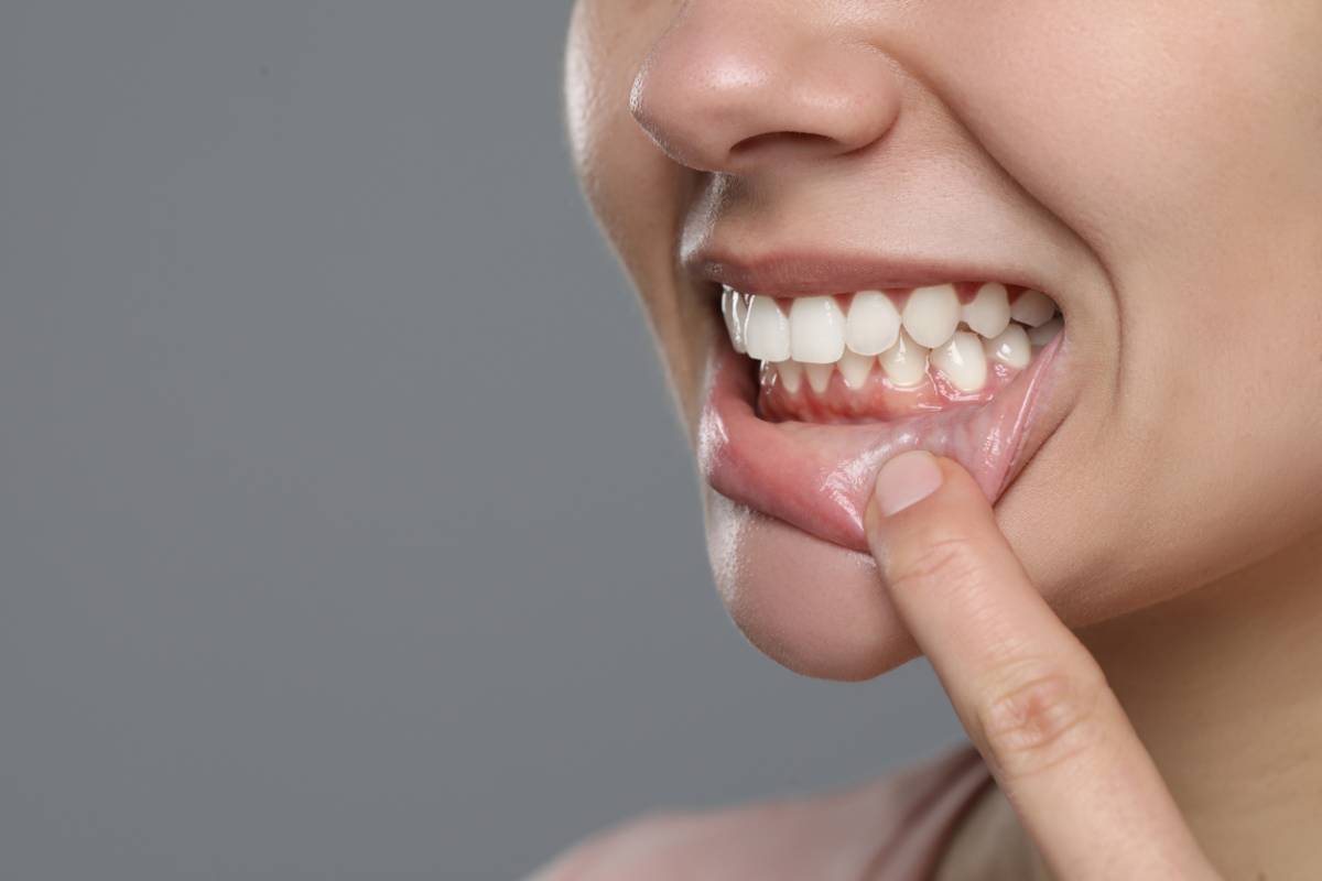 featured image for how to improve gum health