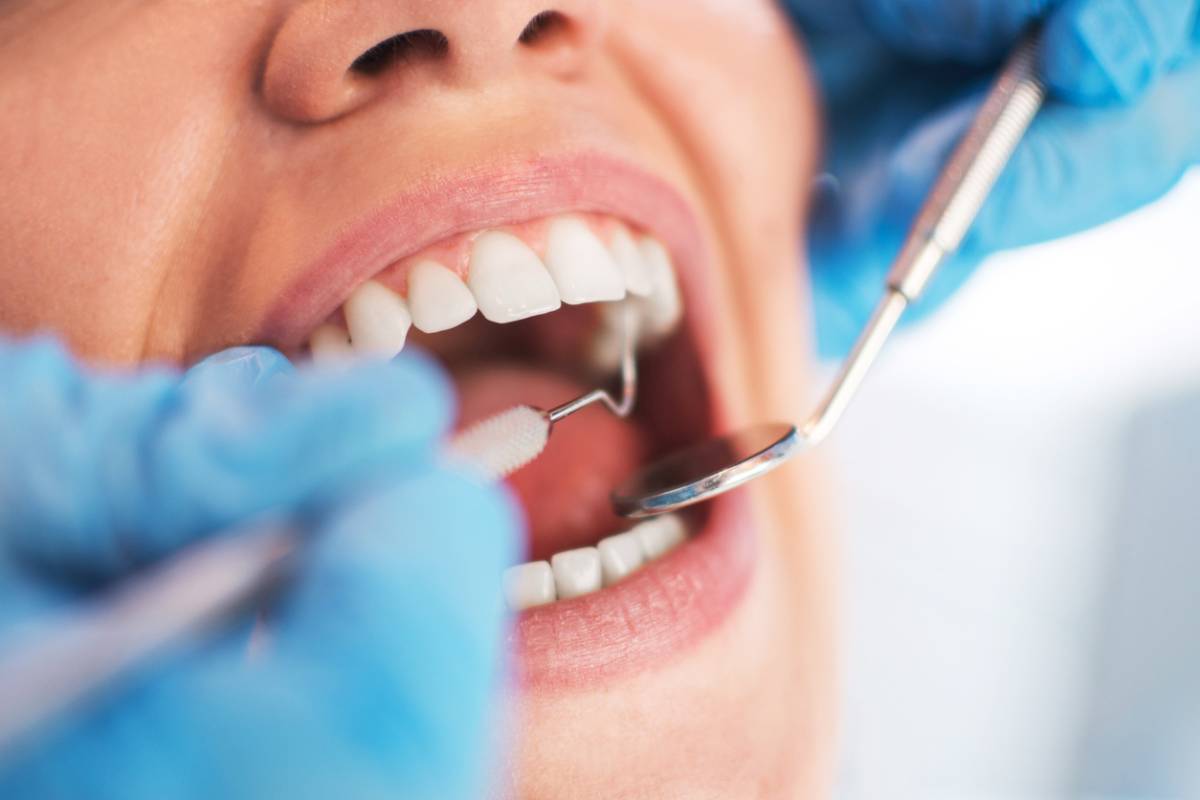 Featured image for Who Is (and Is Not) a Candidate for Pinhole Dental Surgery?